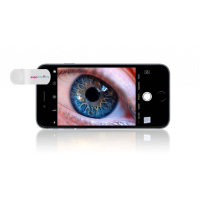 LENSO - zestaw obiektywów do smartfona